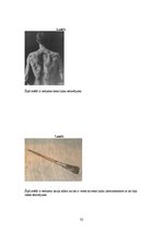 Referāts 'Tetovējumu ietekme uz cilvēku veselību', 32.