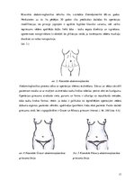 Diplomdarbs 'Ķirurģiskas ārstēšanas iespējas pēcdzemdību izmaiņām vēdera priekšēja sienā', 17.