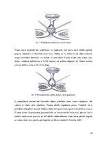 Diplomdarbs 'Ķirurģiskas ārstēšanas iespējas pēcdzemdību izmaiņām vēdera priekšēja sienā', 20.