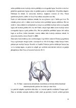 Diplomdarbs 'Ķirurģiskas ārstēšanas iespējas pēcdzemdību izmaiņām vēdera priekšēja sienā', 22.