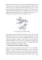 Diplomdarbs 'Ķirurģiskas ārstēšanas iespējas pēcdzemdību izmaiņām vēdera priekšēja sienā', 24.