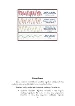 Referāts 'Cilvēka galvas smadzenes, to struktūras un funkcijas', 12.