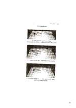 Referāts 'Stājas traucējumu profilakse', 15.