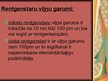 Prezentācija 'Rentgenstarojums', 5.