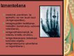 Prezentācija 'Rentgenstarojums', 6.