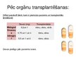 Prezentācija 'Medikaments "Tacrolimus"', 8.