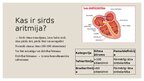 Prezentācija 'Dzīvībai bīstamas aritmijas', 2.