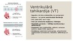 Prezentācija 'Dzīvībai bīstamas aritmijas', 5.