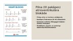 Prezentācija 'Dzīvībai bīstamas aritmijas', 12.