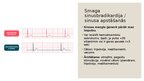 Prezentācija 'Dzīvībai bīstamas aritmijas', 13.