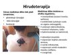 Prezentācija 'Hirudo medicinalis - medicīnas dēle', 8.