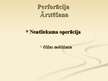 Prezentācija 'Gremošanas sistēmas ķirurģija', 48.