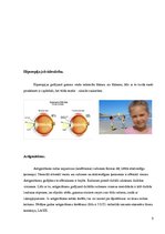 Konspekts 'Redzes korekcija ar lāzeru', 5.