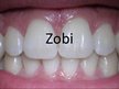 Prezentācija 'Zobi', 1.