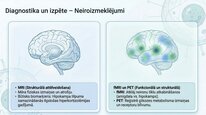 Prezentācija 'Kortizola loma organismā un stresa reakcijā', 20.