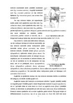 Diplomdarbs 'Datortomogrāfijas izmeklējuma kvalitātes izvērtējums ceļa locītavas traumu gadīj', 13.