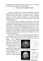 Diplomdarbs 'Datortomogrāfijas izmeklējuma kvalitātes izvērtējums ceļa locītavas traumu gadīj', 15.