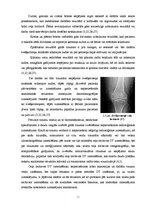 Diplomdarbs 'Datortomogrāfijas izmeklējuma kvalitātes izvērtējums ceļa locītavas traumu gadīj', 23.