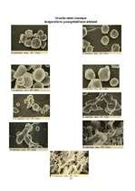 Referāts 'Ciete', 11.