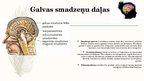 Prezentācija 'Galvas smadzeņu daļas un iegarenās smadzenes', 4.