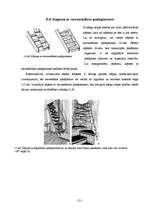 Referāts 'Kāpnes', 21.