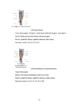 Referāts 'Fizioterapija pēc augšstilba kaula lūzuma', 12.