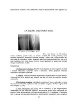 Referāts 'Fizioterapija pēc augšstilba kaula lūzuma', 18.