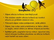 Referāts 'Laterālais epikondilīts jeb tenisista elkonis', 33.