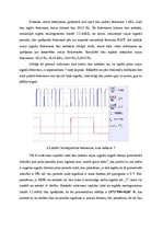 Paraugs 'Skaitītāji un frekvenču dalītāji', 9.
