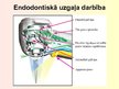 Prezentācija 'Stomatoloģija. Endodontijas ierīces', 9.