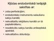 Prezentācija 'Stomatoloģija. Endodontijas ierīces', 12.