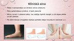 Prezentācija 'Kāju un pēdu deformācijas. Ārstēšana, fizioterapija', 11.