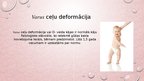 Prezentācija 'Kāju un pēdu deformācijas. Ārstēšana, fizioterapija', 30.