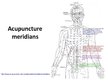 Prezentācija 'Acupuncture', 4.