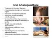 Prezentācija 'Acupuncture', 5.