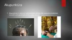 Prezentācija 'Akupunktūra', 2.