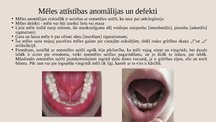 Prezentācija 'Dislālija - artikulācijas traucējumi perifērajā runas aparātā', 20.