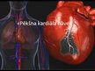 Prezentācija 'Pēkšņa kardiāla nāve', 1.