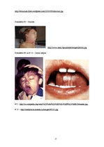 Referāts 'Bērnu infekcijas slimības', 27.