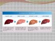 Prezentācija 'Liver - Anatomy and Functions', 12.