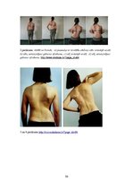 Referāts 'Fizioterapija', 53.