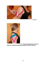 Referāts 'Fizioterapija', 54.