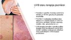 Prezentācija 'Fototerapija', 9.