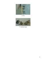 Referāts 'Nerūsējošais tērauds zobu protēžu tehnikā', 9.