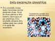 Prezentācija 'Ērču encefalīts', 10.