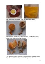 Referāts 'Medikamenti un zāļu tējas imunitātes stiprināšanai', 36.