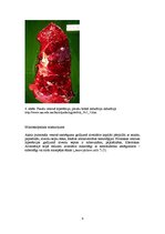 Konspekts 'Plaušu venozā hiperēmija (plaušu būnā indurācija)', 9.