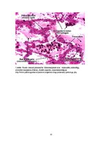 Konspekts 'Plaušu venozā hiperēmija (plaušu būnā indurācija)', 10.