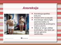 Prezentācija 'Anoreksija un bulīmija', 2.