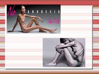 Prezentācija 'Anoreksija un bulīmija', 4.